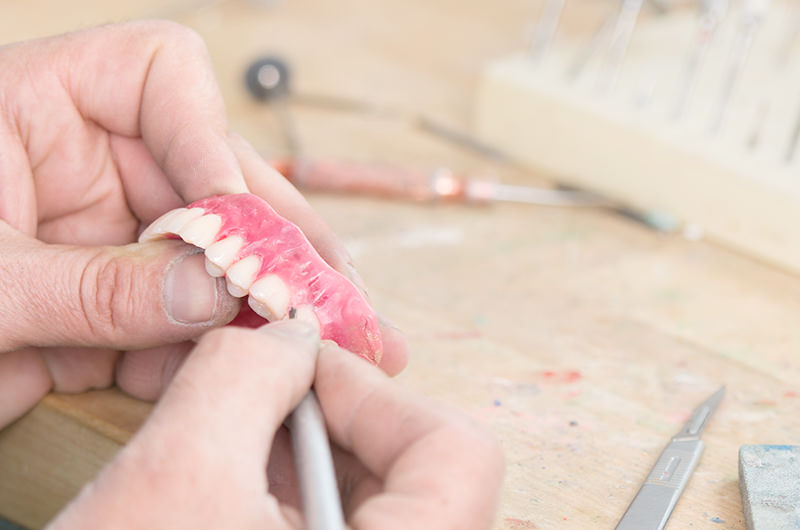 院内の歯科技工所で精密な入れ歯を作製
